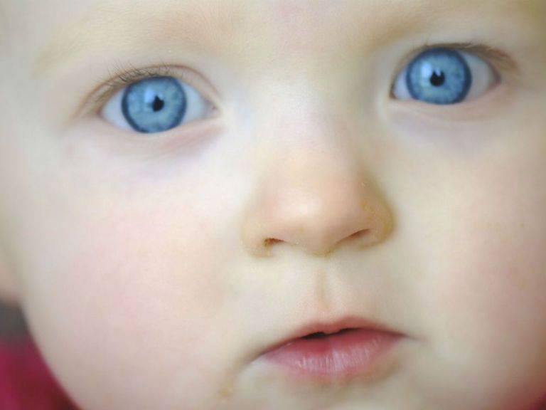Причины появления синяков под глазами у малыша: от чего у ребенка синева в подглазинах