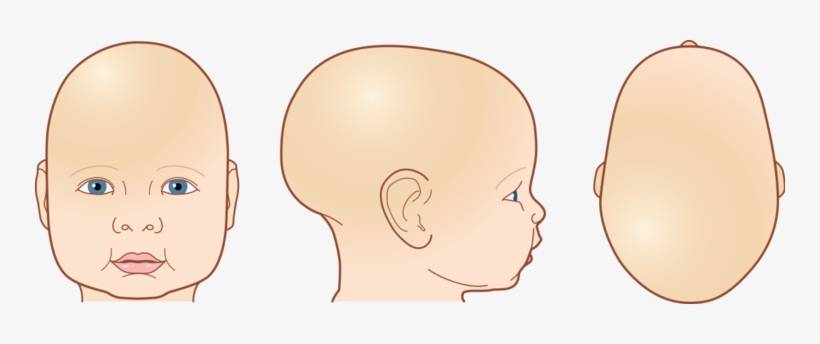 Особенности строения черепа новорожденного - семейный доктор