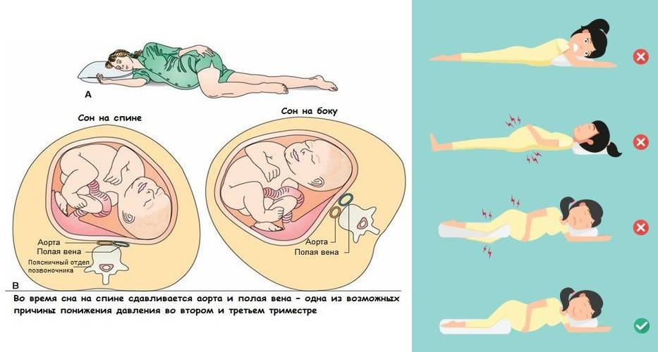 Биоревитализация во время беременности