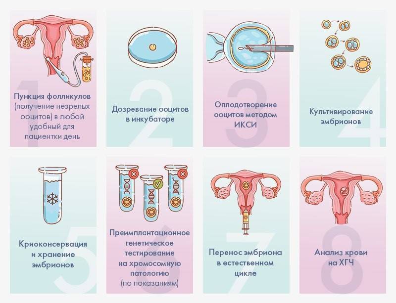 Лечение бесплодия: все о методах современного лечения женского бесплодия
