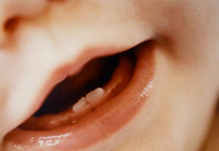 Комаровский: при прорезывании зубов у ребенка могут быть сопли насморк