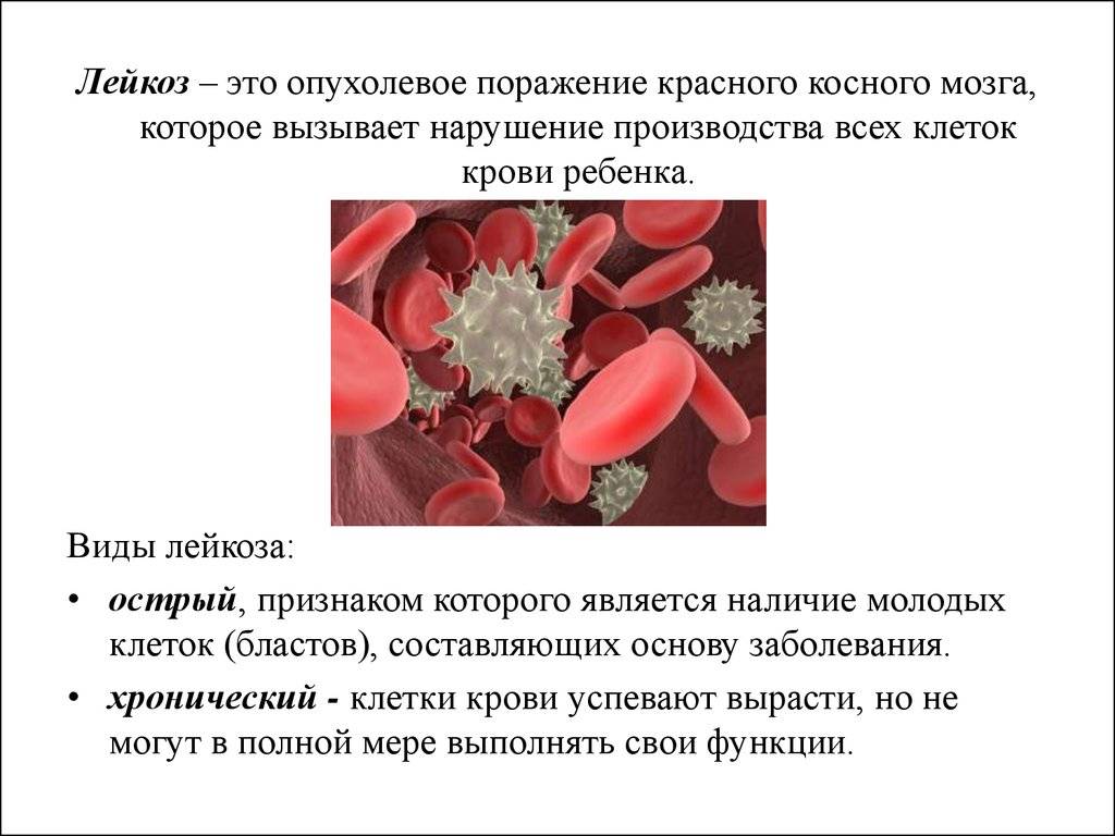 Врожденные и генетические заболевания | полный список заболеваний