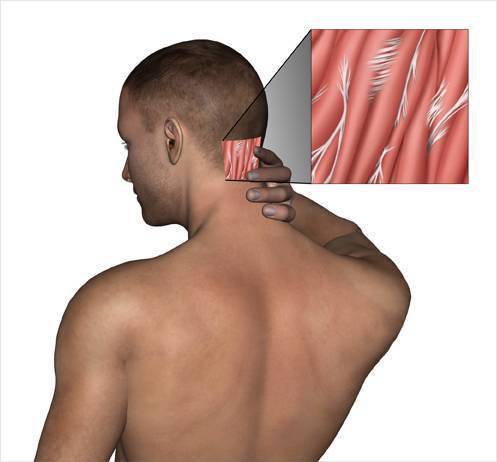 Болит голова и шея: шейный отдел и головная боль | ким