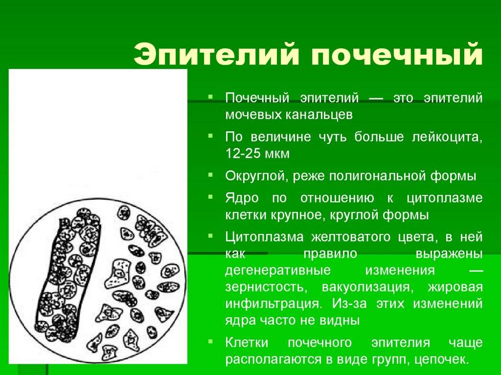 Инфекции мочевыводящих путей (имвп) у детей. информация для родителей. - доказательная медицина для всех