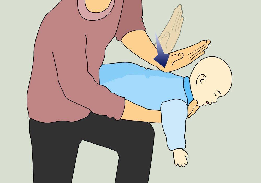 Обструкция. что делать, если ребенок задыхается