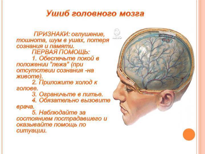 Сотрясение мозга