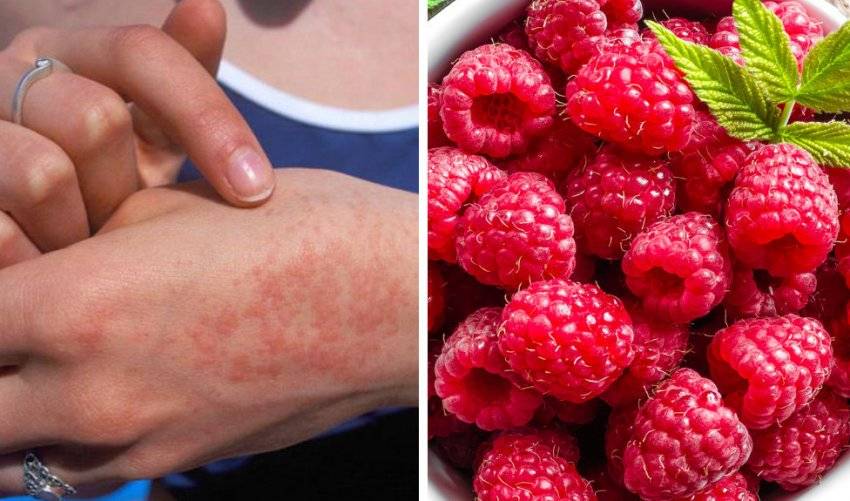 Аллергия на ягоды