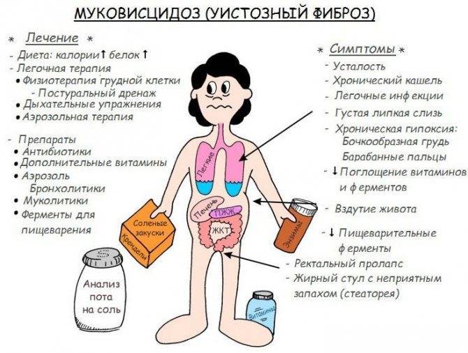Муковисцидоз у детей - сибирский медицинский портал