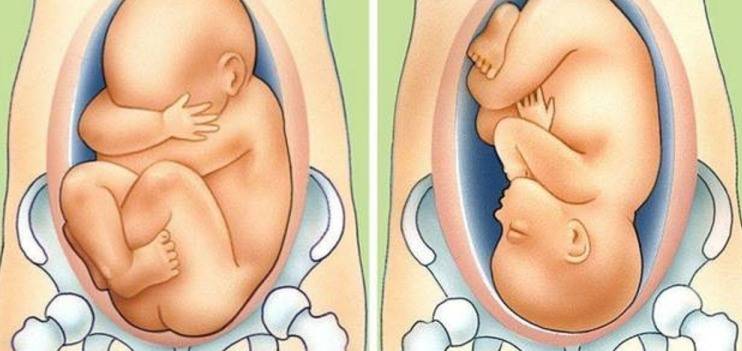 Где находится ребенок во время беременности или расположение плода в матке по неделям беременности