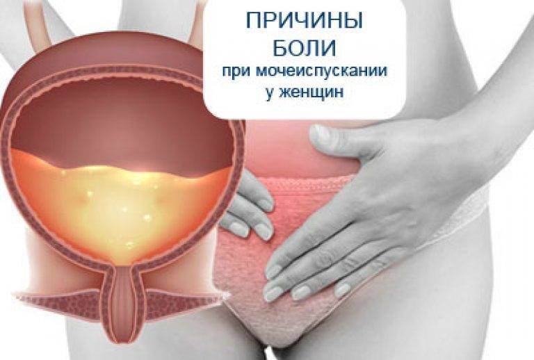 Жжение при мочеиспускании и рези во влагалище при беременности