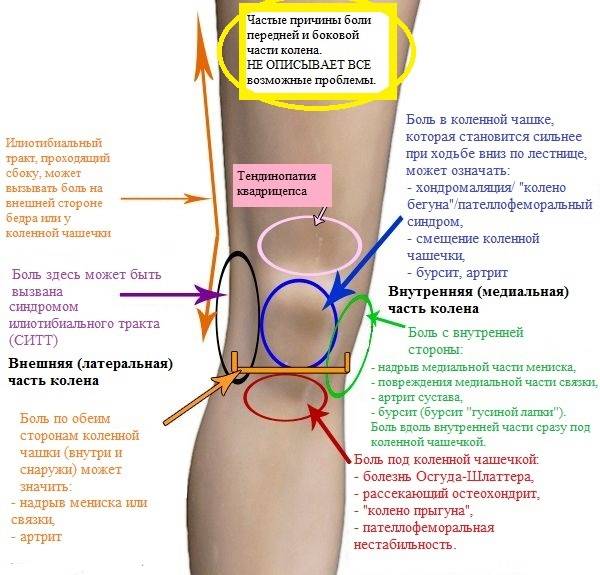 Локтевой бурсит - лечение, симптомы, причины, диагностика | центр дикуля