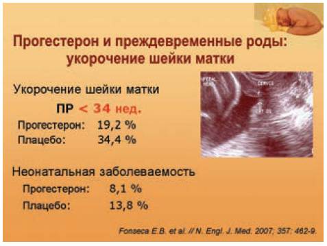 Ведение беременности у женщин с рубцом на матке