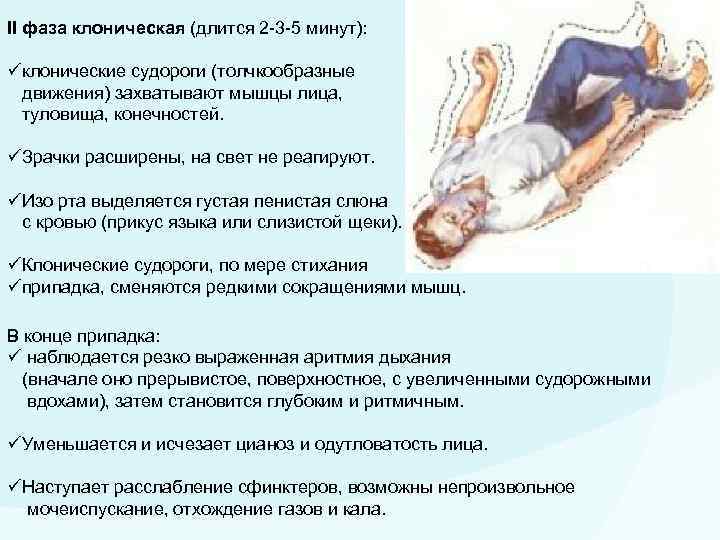Ответы на тест нмо "неотложная помощь при судорожном синдроме в педиатрии" | medtema.ru