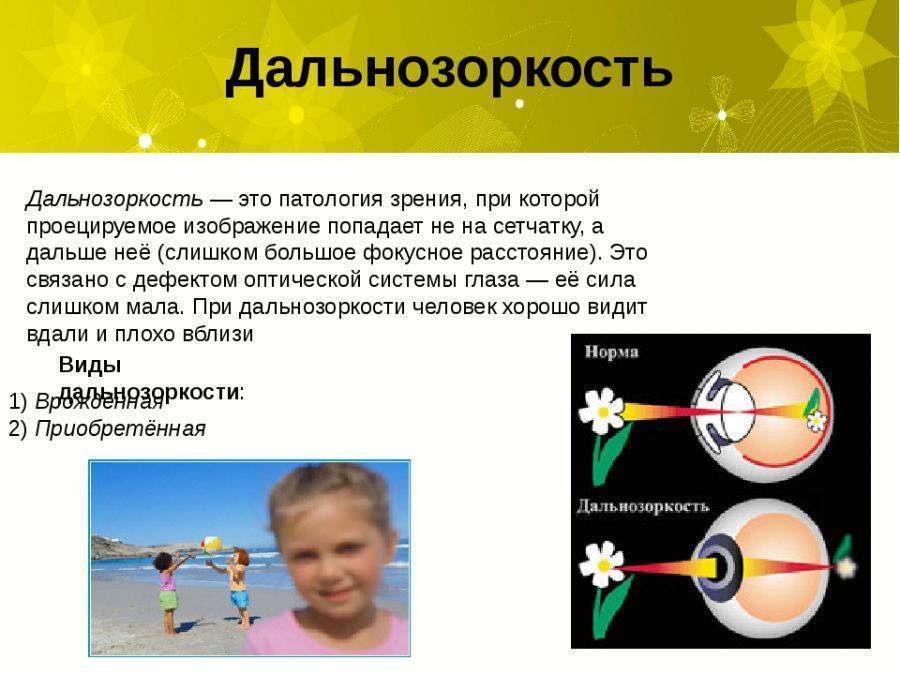 Лечение дальнозоркости у детей: как лечить детскую гиперметропию? - детская поликлиника № 7