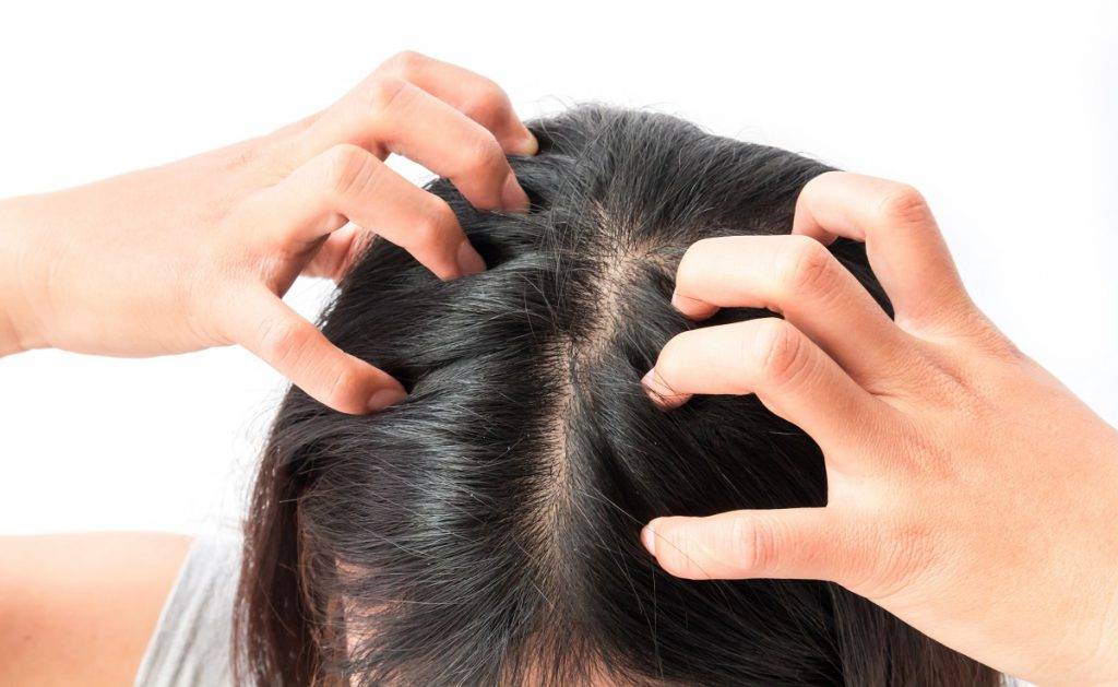 Выпадение волос у детей и подростков: причины, лечение