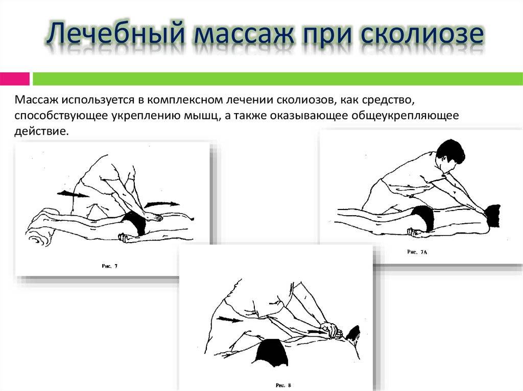 Упражнения для профилактики сколиоза