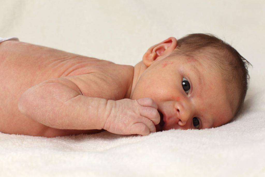 Кожа у новорожденного: строение, болезни, правильный уход | компетентно о здоровье на ilive