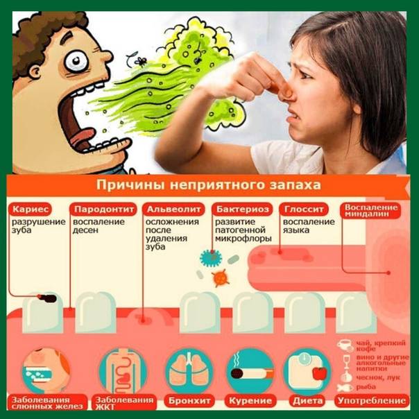 Как убрать неприятный запах изо рта – причины, как избавиться быстро