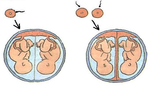 Перинатальные исходы при монохориальной многоплодной беременности, осложненной синдромом селективной задержки роста плода
