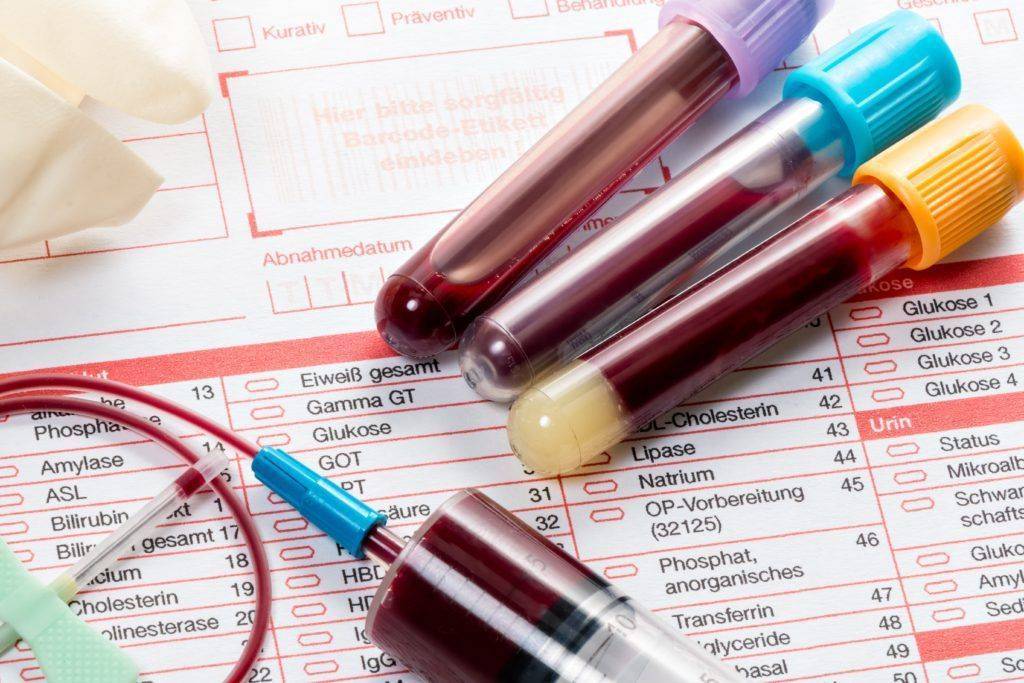 Как правильно сдавать общий анализ крови ребенку - натощак или нет? расшифровка и нормы результатов - parentchild.ru