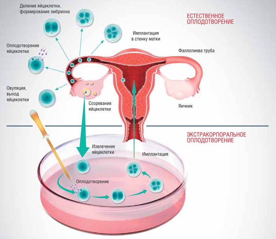 Криоперенос эмбриона – особенности