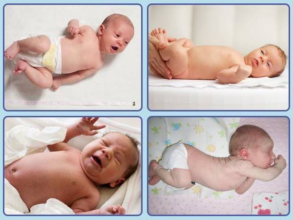 Гипертонус у новорожденных детей до года: тонус мышц у грудничков (симптомы)