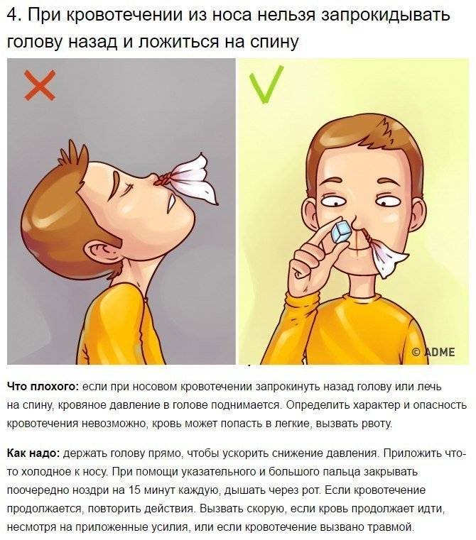 Болит голова и кровь из носа