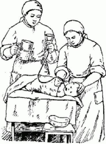 Промывание желудка. техника и алгоритм промывания желудка при отравлении.  промывание желудка у детей. показания и противопоказания.