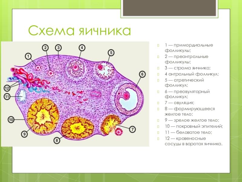 Синдром поликистозных яичников