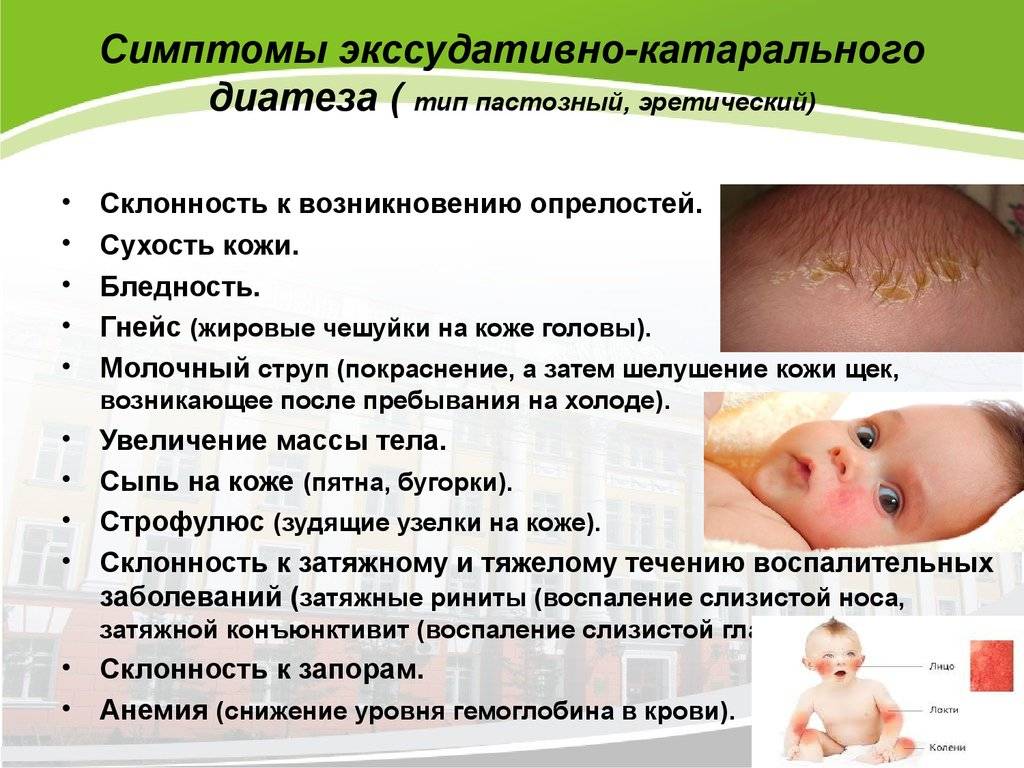 Диатез у грудничков: симптомы, лечение, профилактика (фото у новорожденных)