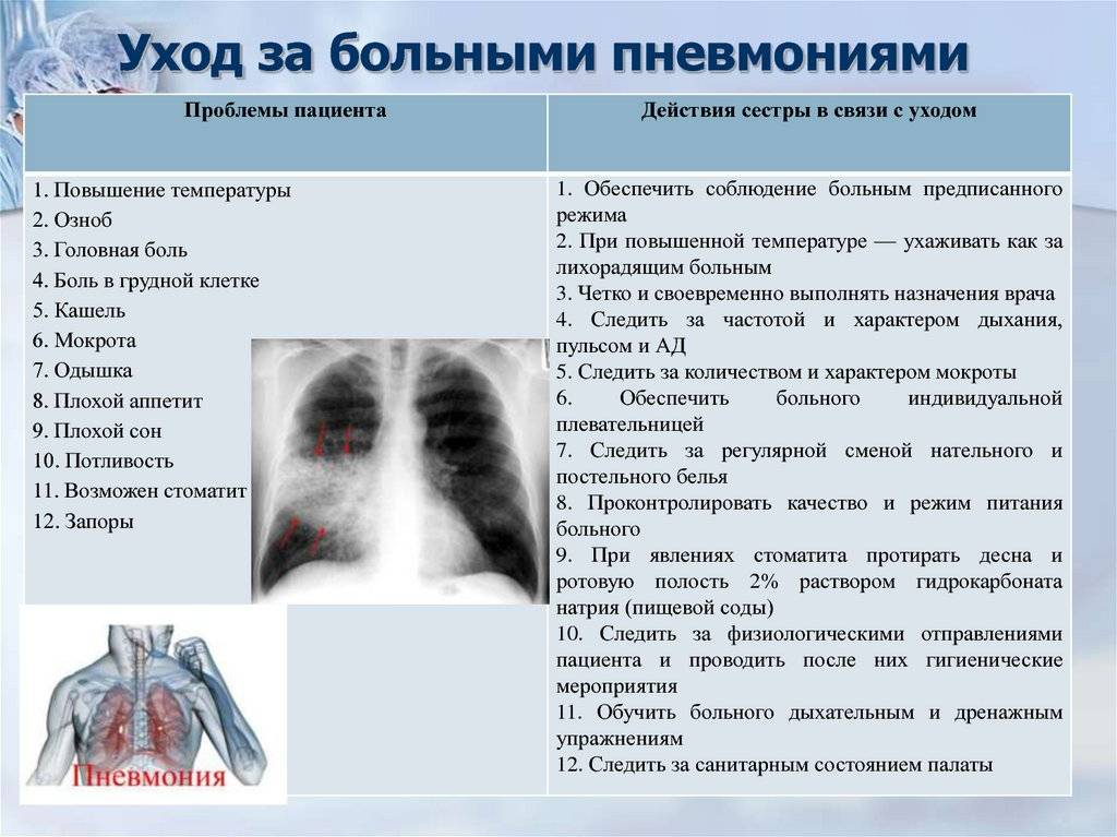 Очаговая пневмония : причины, симптомы, диагностика, лечение | компетентно о здоровье на ilive