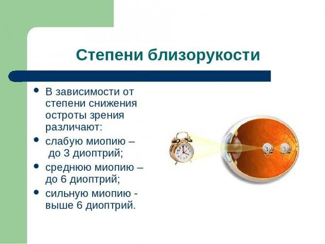 Упражнения для лечения близорукости у детей - энциклопедия ochkov.net