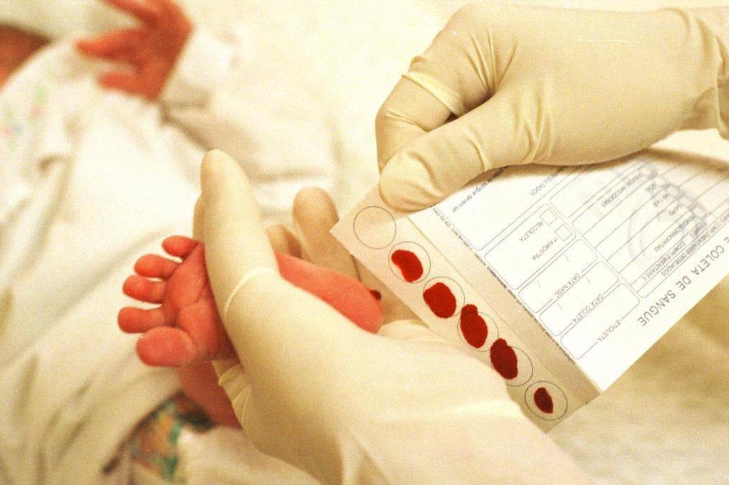 Неонатальный скрининг новорожденных. зачем берут кровь из пяточки?