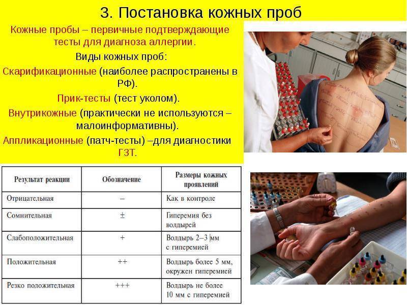 Аллергопробы - цена в москве, сдать аллергопробы в «нии эпидемологии»