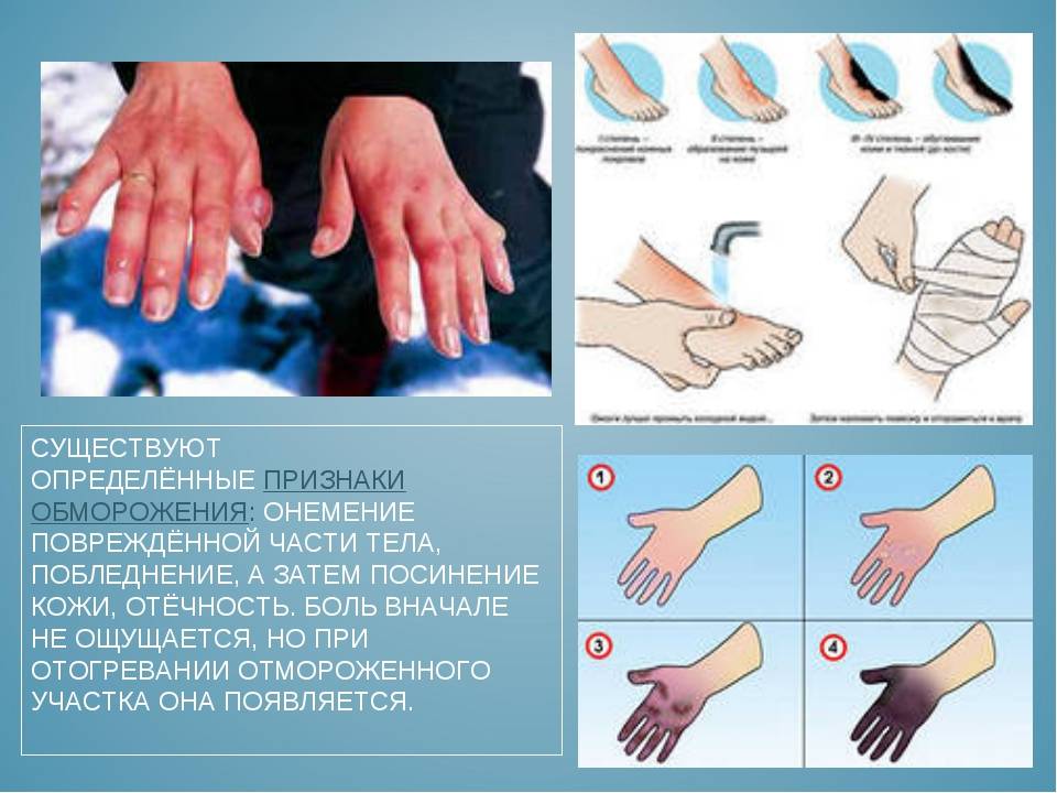 ᐉ онемение рук, ног, пальцев: причины, симптомы, диагностика, лечение