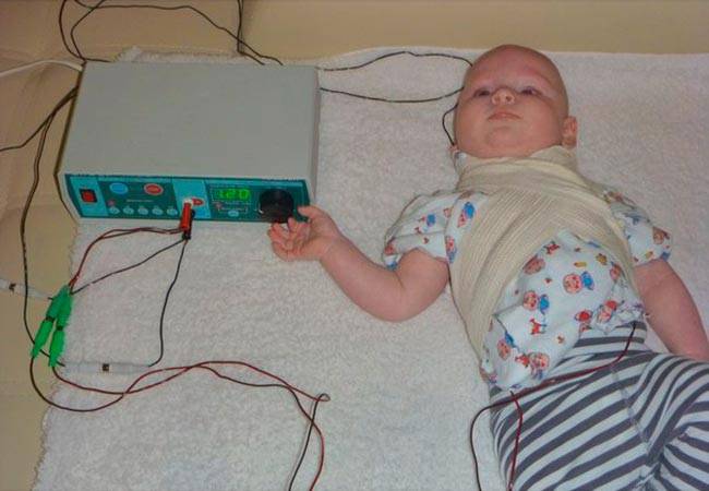 Электрофорез для детей – что это такое, для чего и с чем назначают?