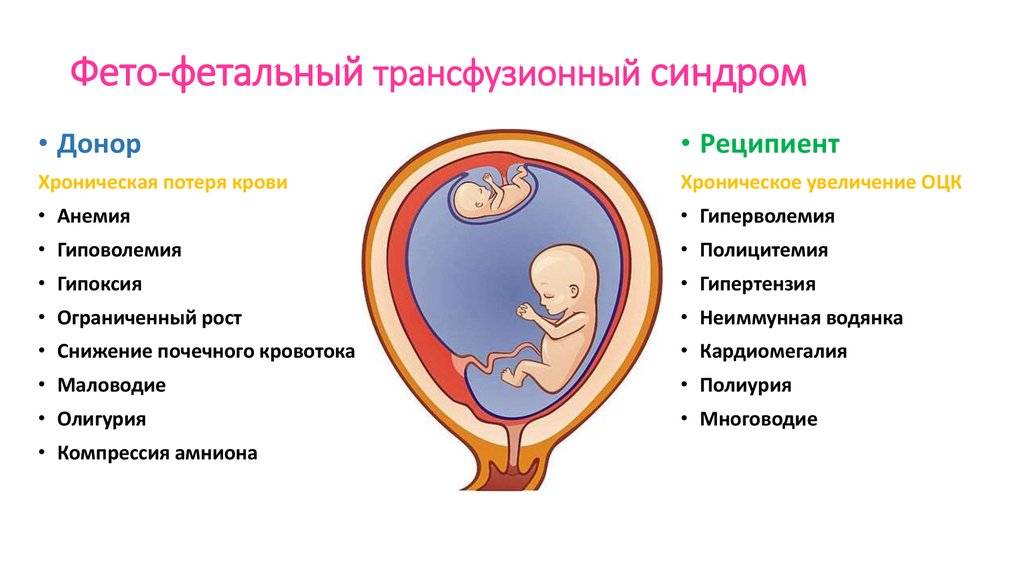 Многоплодная беременность при эко: как выносить и родить