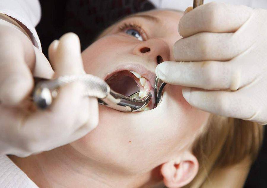 Пульпит молочных зубов у детей, как обнаружить и лечение