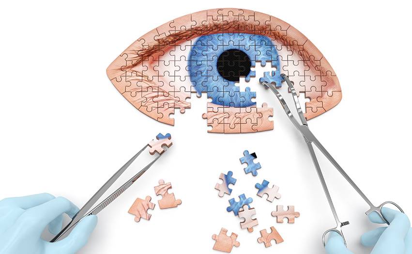 Склеропластика глаз у детей: за и против