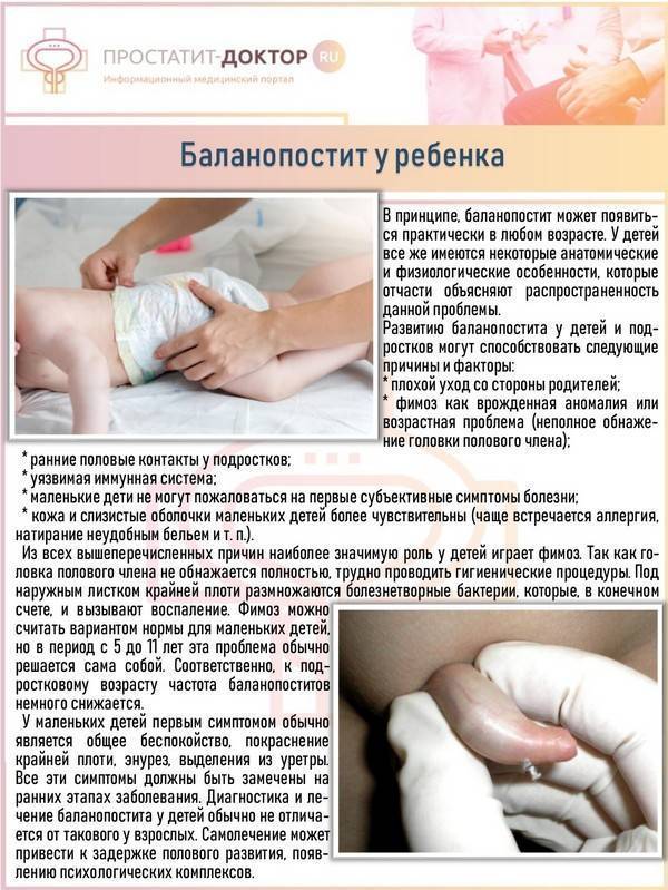 Синехии крайней плоти | клиника "центр эко" в москве