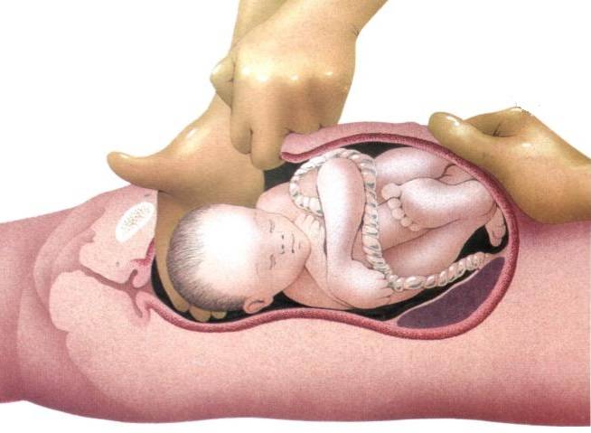 Вскармливание младенца, рожденного через кесарево сечение. грудное вскармливание после кесарева