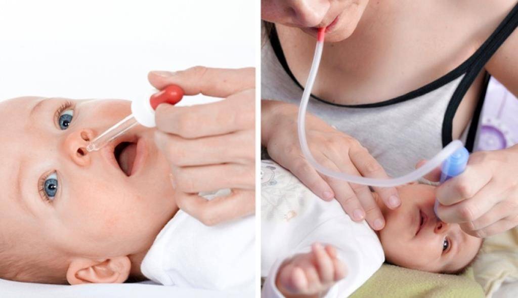 Почему у новорожденного ребенка пахнут уши