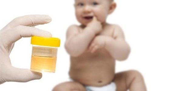 Пахнет моча у ребенка: почему сильный неприятный запах мочи у грудничка