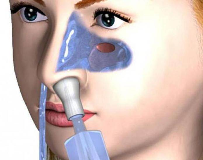 Чем лечить выделения из носа?