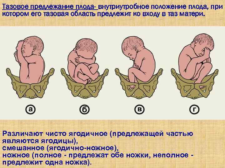 Как ребенок лежит в животе: каким должно быть положение плода на разных неделях беременности?
