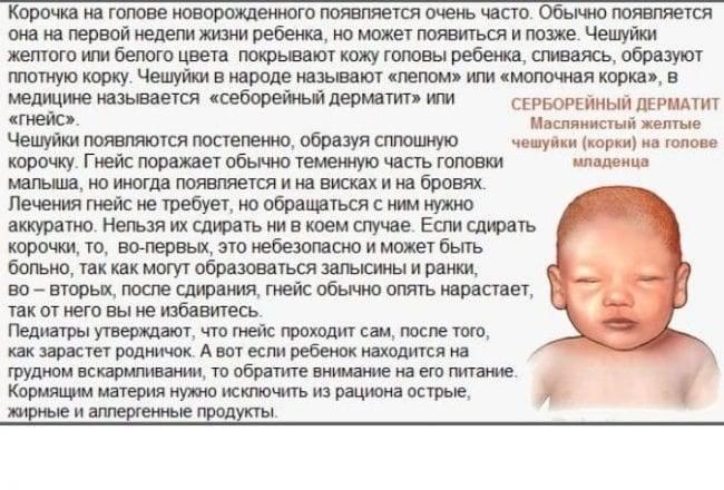 Cтекание слизи по задней стенке глотки