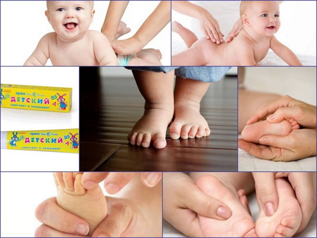 Комплекс лфк при вальгусной деформации стопы у детей