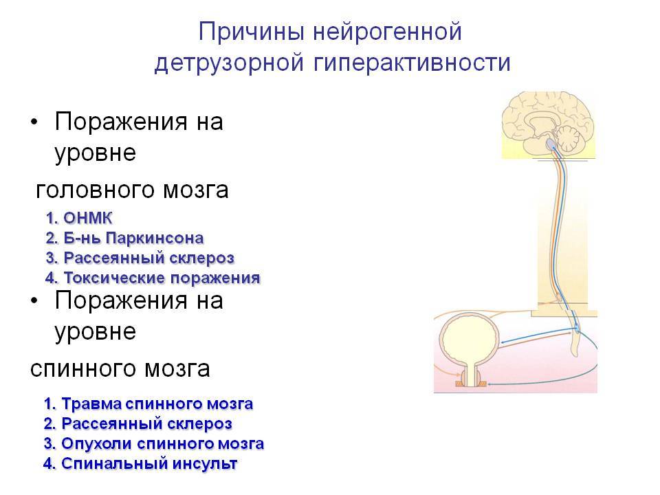 Лечение нейрогенного мочевого пузыря у женщин препараты схема