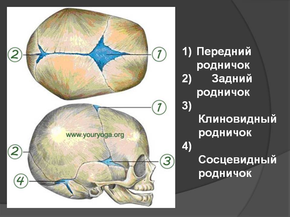Роднички таблица. Передний Родничок черепа новорожденного. Роднички черепа новорождённого . Клиновидный и сосцевидный. Сосцевидный Родничок черепа. Клиновидный Родничок у новорожденных.