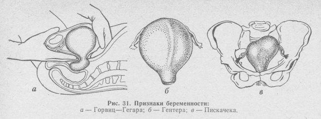Кольпоскопия при беременности